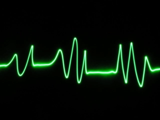 Kalp Atışı Kaç Olmalı?